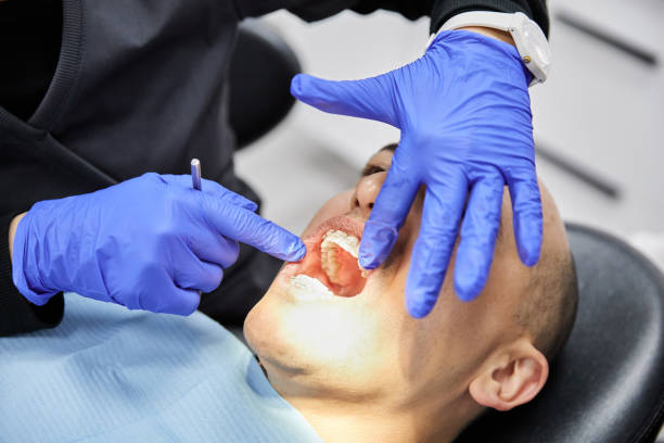 Best Emergency Dentist for Lost Fillings or Crowns in Peoria, IL