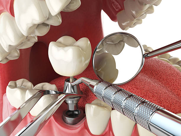 Best Holiday Emergency Dentist in Peoria, IL